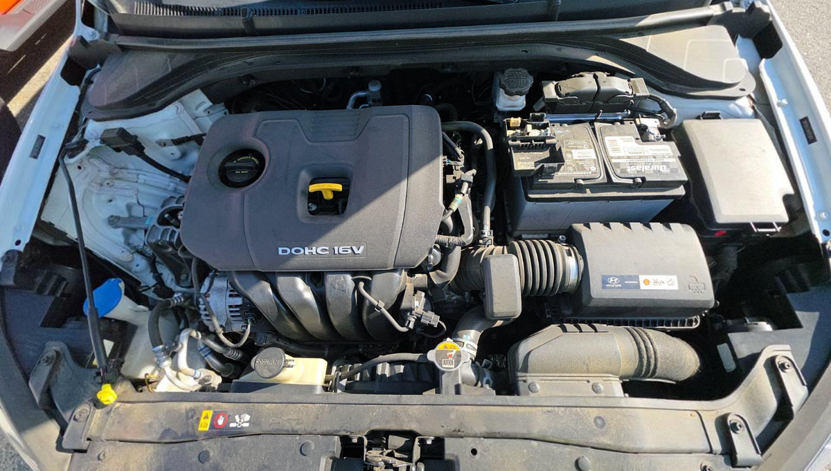 2017 Hyundai Elantra SE Sedan